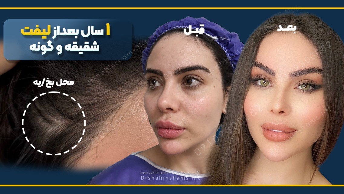 دکتر شاهین شمس | متخصص جراحی زیبایی صورت و لیفت